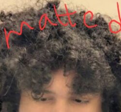 Matted Hair
