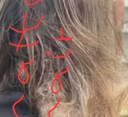 Matted Hair Alt